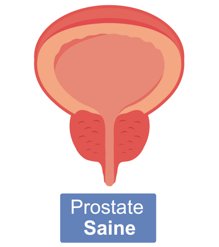 Prostaless - Prostate-saine