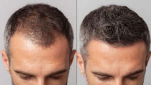 Cheveux